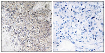 p70 S6 kinase α (phospho Thr444) rabbit pAb Antibody