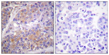 p70 S6 kinase α (phospho Ser371) rabbit pAb Antibody