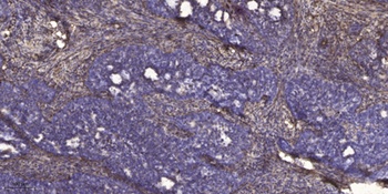Ribosomal Protein S18 rabbit pAb Antibody