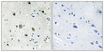 Ribosomal Protein S20 rabbit pAb Antibody