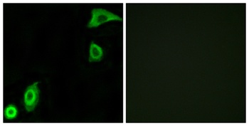 Ribosomal Protein S20 rabbit pAb Antibody