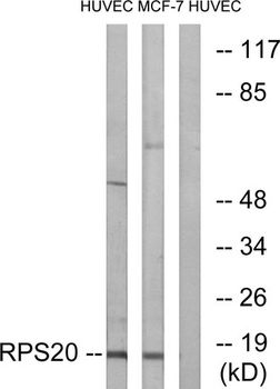 Ribosomal Protein S20 rabbit pAb Antibody