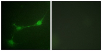 Ataxin-1 (phospho Ser776) rabbit pAb Antibody