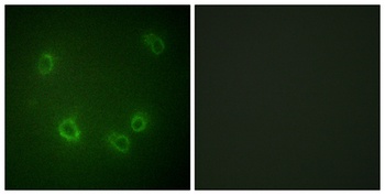 ENaC β (phospho Thr615) rabbit pAb Antibody