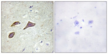 ENaC β (phospho Thr615) rabbit pAb Antibody