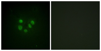 BLM rabbit pAb Antibody