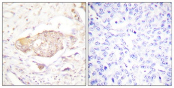 SGK1 (phospho Ser422) rabbit pAb Antibody