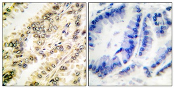 SGK1 (phospho Ser422) rabbit pAb Antibody