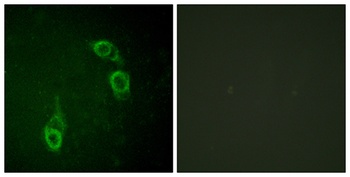 APC1 rabbit pAb Antibody