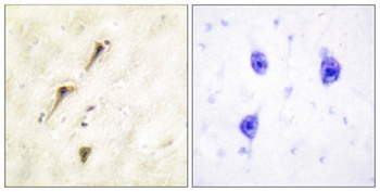 APC1 rabbit pAb Antibody