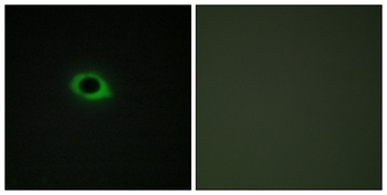 Tensin3 rabbit pAb Antibody