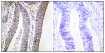 p47-phox (phospho Ser359) rabbit pAb Antibody