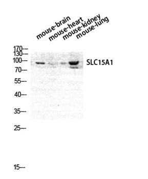 PEPT1 rabbit pAb Antibody