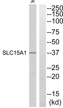 PEPT1 rabbit pAb Antibody