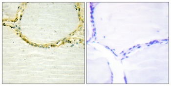 Bmx (phospho Tyr566) rabbit pAb Antibody