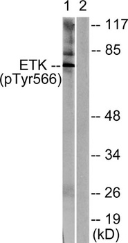 Bmx (phospho Tyr566) rabbit pAb Antibody