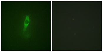 Bmx (phospho Tyr40) rabbit pAb Antibody