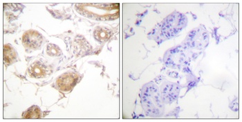 Bmx (phospho Tyr40) rabbit pAb Antibody