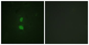 SNAI 1 (phospho Ser246) rabbit pAb Antibody