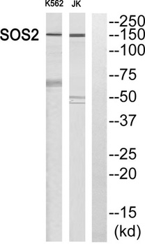 Sos 2 rabbit pAb Antibody