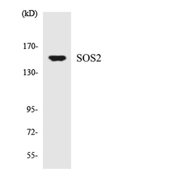 Sos 2 rabbit pAb Antibody