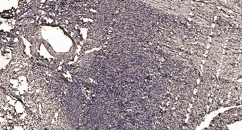 Sos 2 rabbit pAb Antibody