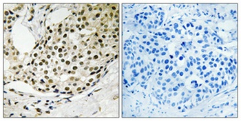 SSB (phospho Ser366) rabbit pAb Antibody