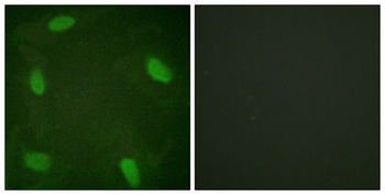 SSB (phospho Ser366) rabbit pAb Antibody