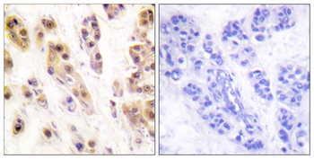 SSB (phospho Ser366) rabbit pAb Antibody