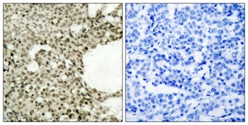 Stat1 (phospho Ser727) rabbit pAb Antibody