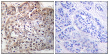 Stat5a/b (phospho Ser726/731) rabbit pAb Antibody