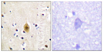 Krs-1/2 (phospho Thr183) rabbit pAb Antibody