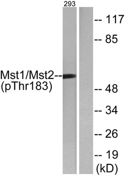 Krs-1/2 (phospho Thr183) rabbit pAb Antibody