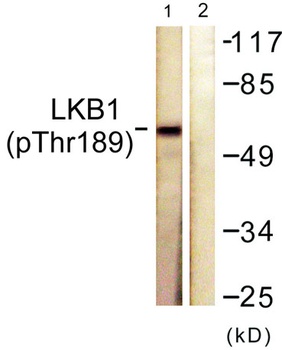 LKB1 (phospho Thr189) rabbit pAb Antibody
