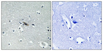 Syntaxin 1 (phospho Ser14) rabbit pAb Antibody