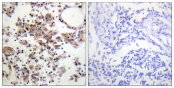 Syk (phospho Tyr323) rabbit pAb Antibody