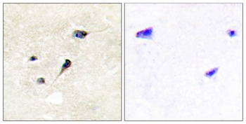 Synapsin I (phospho Ser605) rabbit pAb Antibody