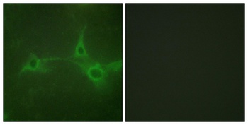TACE rabbit pAb Antibody