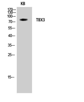 TBX3 rabbit pAb Antibody
