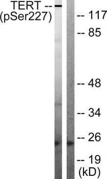 TERT (phospho Ser227) rabbit pAb Antibody