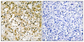 mtTFA rabbit pAb Antibody