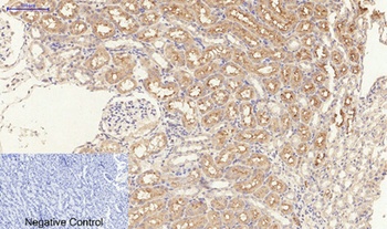 TGFβ RI (phospho Ser165) rabbit pAb Antibody