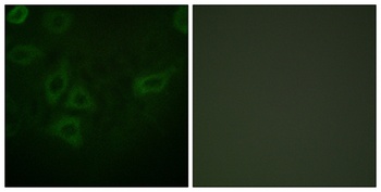 Thymidine Kinase rabbit pAb Antibody