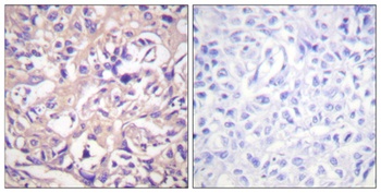 Thymidine Kinase rabbit pAb Antibody