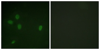 53BP1 (phospho Ser25) rabbit pAb Antibody
