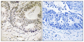 53BP1 (phospho Ser25) rabbit pAb Antibody