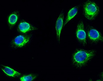Tsg 101 rabbit pAb Antibody