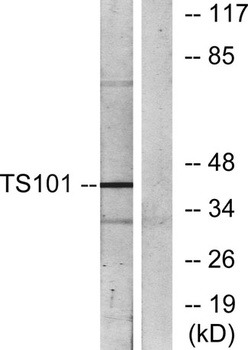 Tsg 101 rabbit pAb Antibody