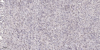 Tsg 101 rabbit pAb Antibody