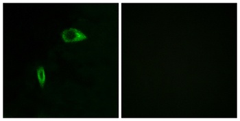 COL14A1 rabbit pAb Antibody